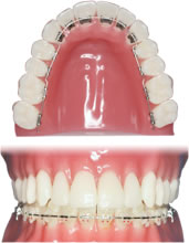 矯正歯科1